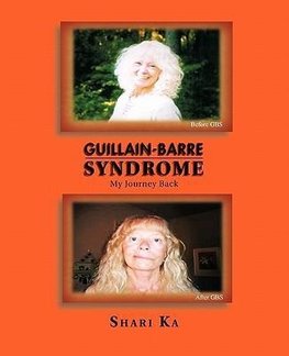 Guillain-Barre Syndrome