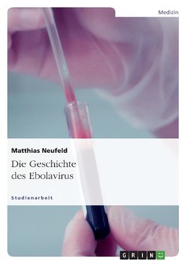 Die Geschichte des Ebolavirus