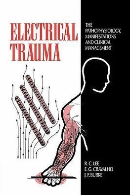 Electrical Trauma