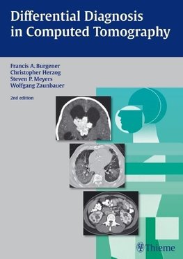 Differential Diagnosis in Computed Tomography