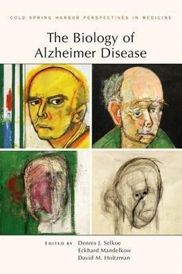 BIOLOGY OF ALZHEIMER DISEASE CB