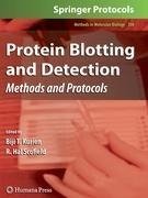 Protein Blotting and Detection