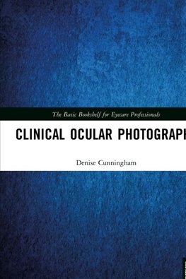 Clinical Ocular Photography