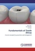 Fundamentals of Tooth Decay