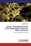 Tissue Transglutaminase (tTG) Expression in Human Brain Tumours