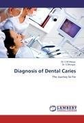 Diagnosis of Dental Caries