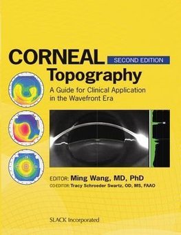 Wang, M:  Corneal Topography