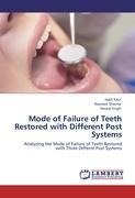 Mode of Failure of Teeth Restored with Different Post Systems