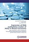 Expression of DNA methylation marker of PITX2 in Breast Carcinoma