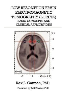 Low Resolution Brain Electromagnetic Tomography (LORETA)