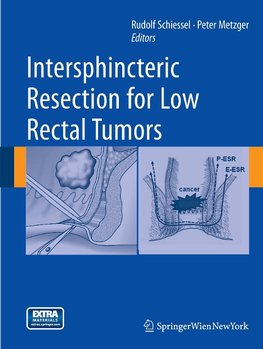 Intersphincteric resection for low rectal tumors