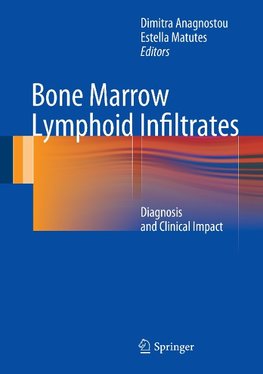 Bone Marrow Lymphoid Infiltrates