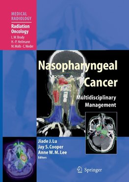 Nasopharyngeal Cancer