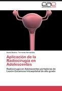 Aplicación de la Radiocirugía en Adolescentes