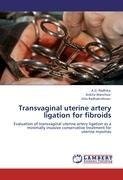 Transvaginal uterine artery ligation for fibroids