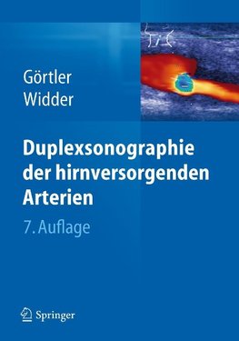 Duplexsonographie der hirnversorgenden Arterien