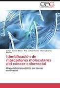 Identificación de marcadores moleculares del cáncer colorrectal