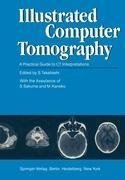 Illustrated Computer Tomography