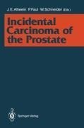 Incidental Carcinoma of the Prostate