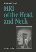 MRI of the Head and Neck