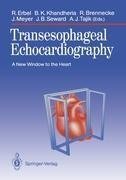 Transesophageal Echocardiography