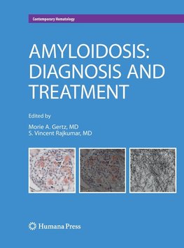 Amyloidosis