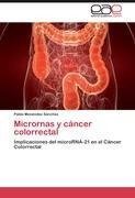 Micrornas y cáncer colorrectal