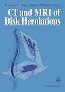 CT and MRI of Disk Herniations