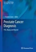 Prostate Cancer Diagnosis