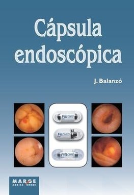 Cápsula endoscópica