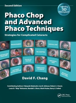 Chang, D:  Phaco Chop and Advanced Phaco Techniques