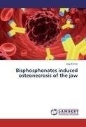 Bisphosphonates induced osteonecrosis of the jaw