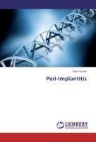 Peri-Implantitis