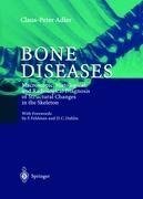 Bone Diseases