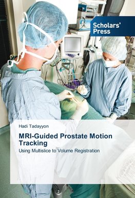 MRI-Guided Prostate Motion Tracking