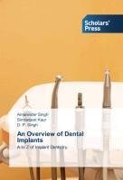 An Overview of Dental Implants