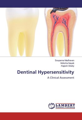 Dentinal Hypersensitivity