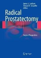 Radical Prostatectomy