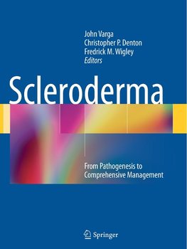 Scleroderma