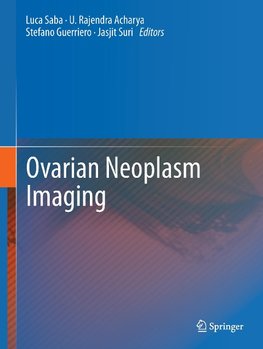 Ovarian Neoplasm Imaging