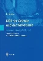 MRT der Gelenke und der Wirbelsäule