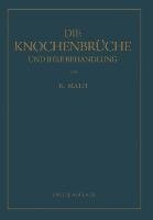 Die Knochenbrüche und ihre Behandlung