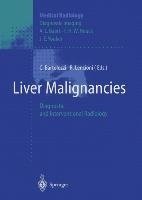 Liver Malignancies