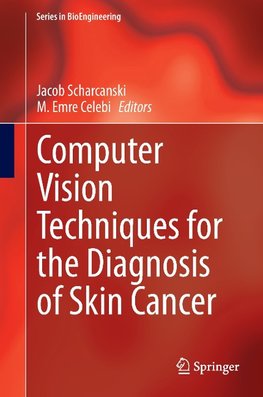 Computer Vision Techniques for the Diagnosis of Skin Cancer