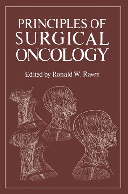 Principles of Surgical Oncology