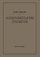 Augenärztliche Eingriffe