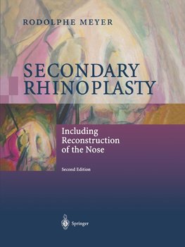 Secondary Rhinoplasty