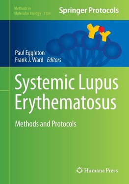 Systemic Lupus Erythematosus