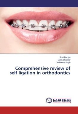 Comprehensive review of self ligation in orthodontics