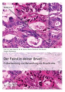 Der Feind in deiner Brust. Früherkennung und Behandlung von Brustkrebs